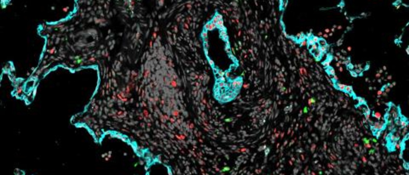 Lung Image